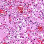 Paraffin pastilles, 56-58, Histology