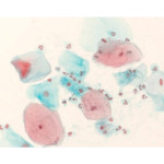 Shorr staining solution 500 ML