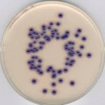 CHROMOCULT COLIFORM AGAR ES