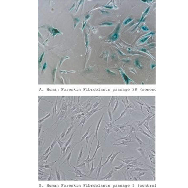 Senescence Cells Histochemical Staining Kit