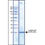 FIBROBLAST GROWTH FACTOR-BASIC HUMAN& 25 UG