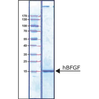 FIBROBLAST GROWTH FACTOR-BASIC HUMAN& 25 UG
