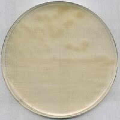 R2A AGAR FOR MICROBIOLOGY