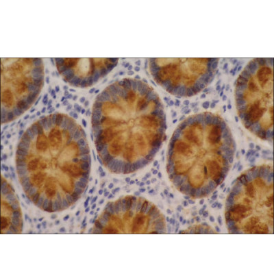 MONOCLONAL ANTI-BLOOD GROUP LEWIS A