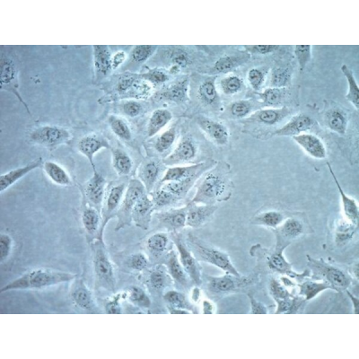 TPC-1 Human Papillary Thyroid Carcinoma 1 VIAL